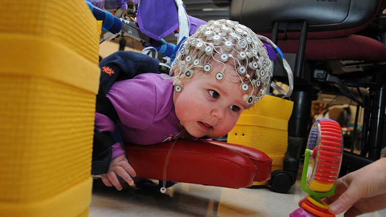 diagnosing cerebral palsy