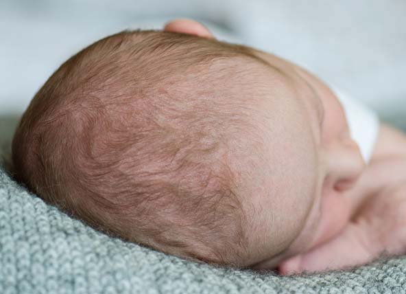 Birth Related Head Injuries