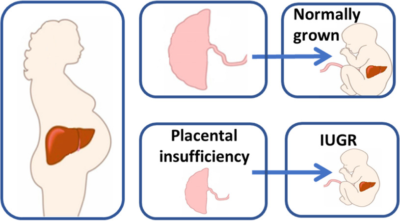 Diagnosing IUGR