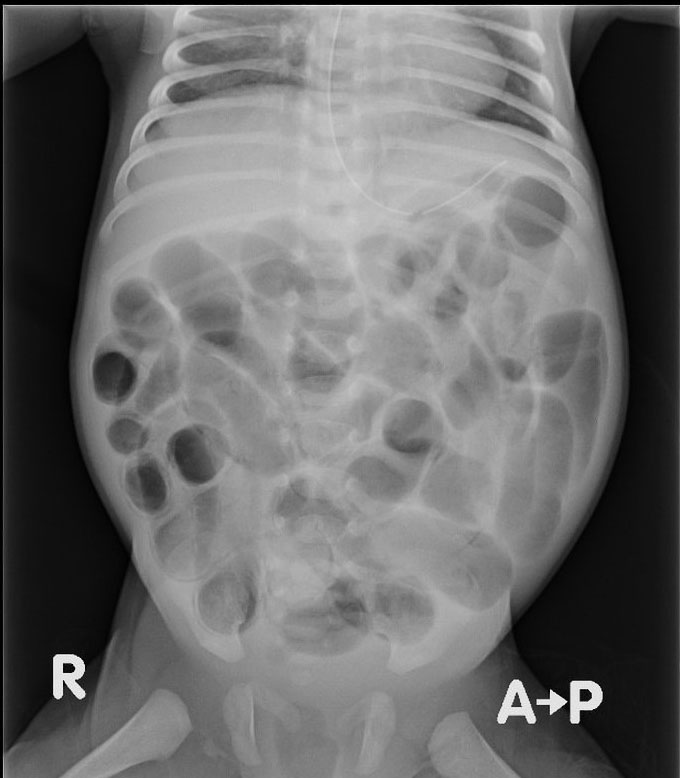 NEC X-Ray