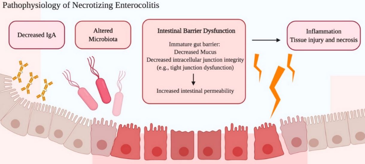 Pathology of NEC