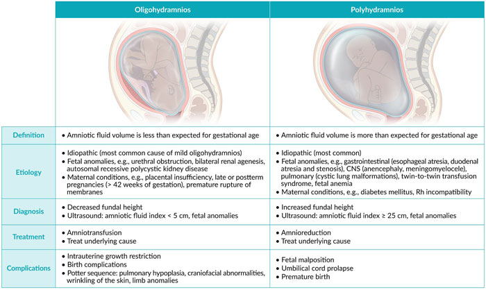 Oligohydramnios Factors