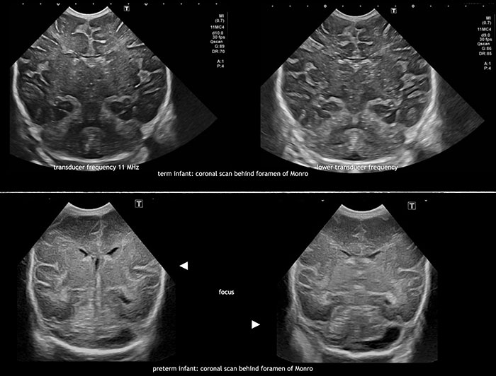 Cranial Scan