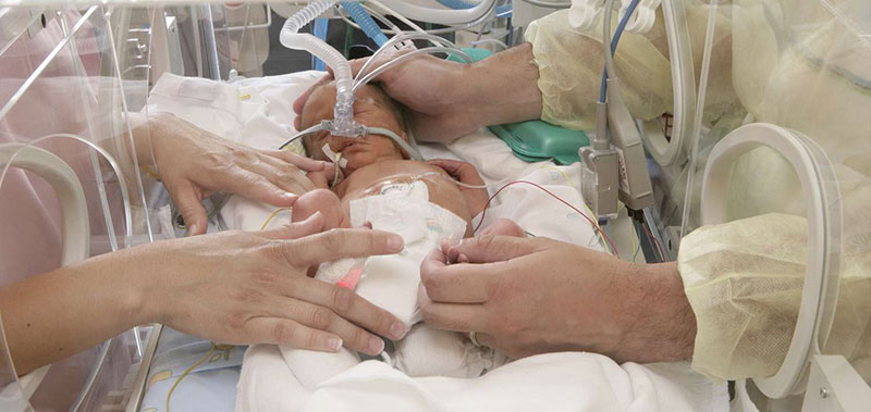 Neonatal Resuscitation Treatment | CPAP