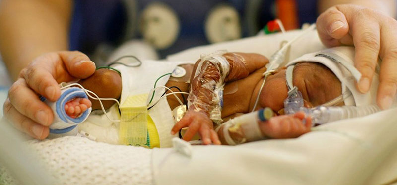 fetal respiratory distress