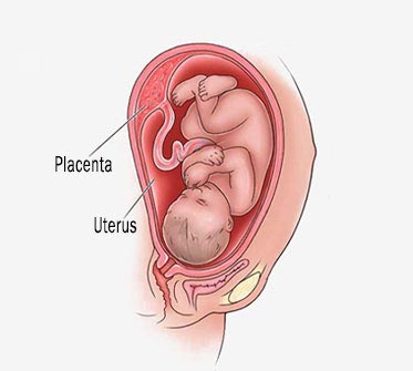 Placental Complications