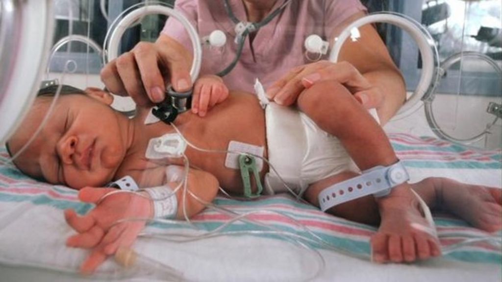 NICU baby