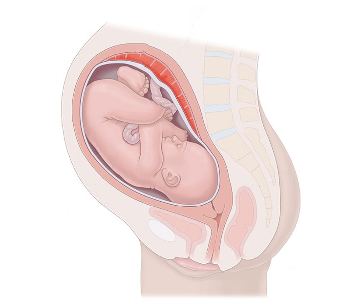 Fetal Hypoxia