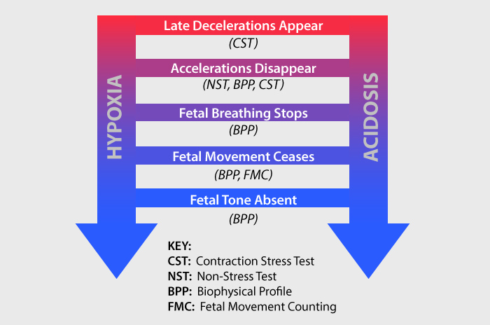 Signs of Fetal Acidosis