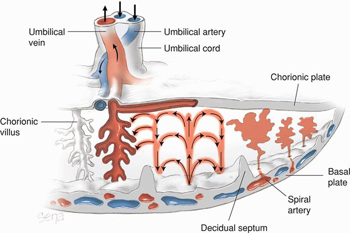 Acute Fetal Acidosis