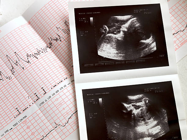 Fetal Monitoring