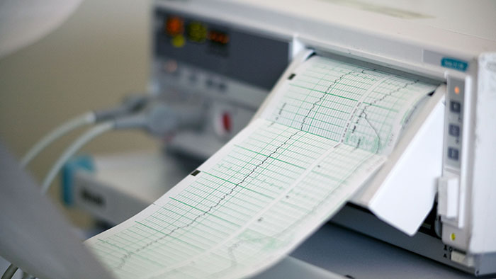 Diagnosing Fetal Bradycardia