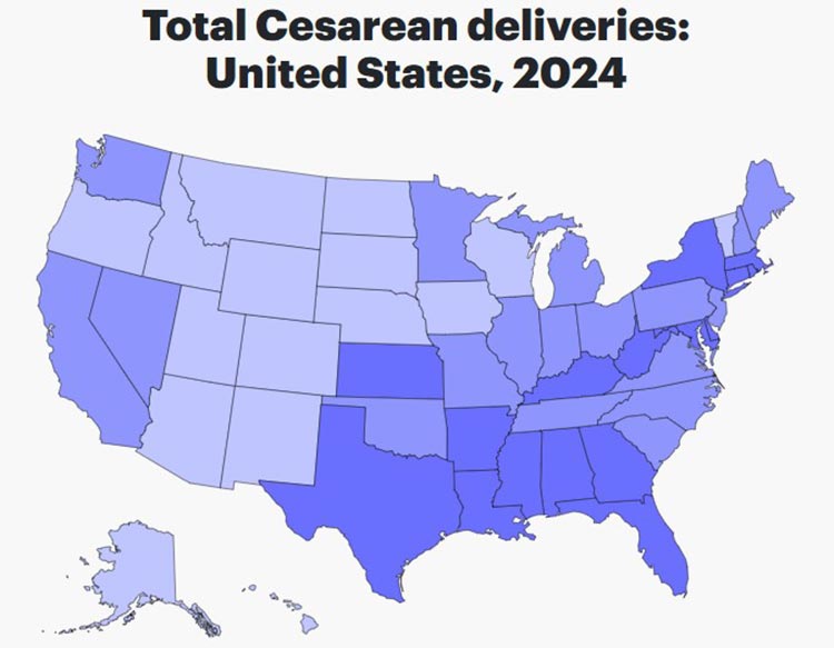 c-sections in the US