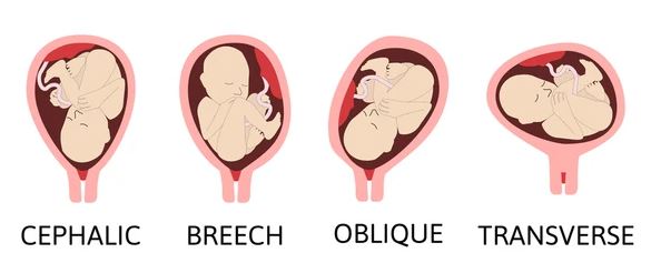 baby positions