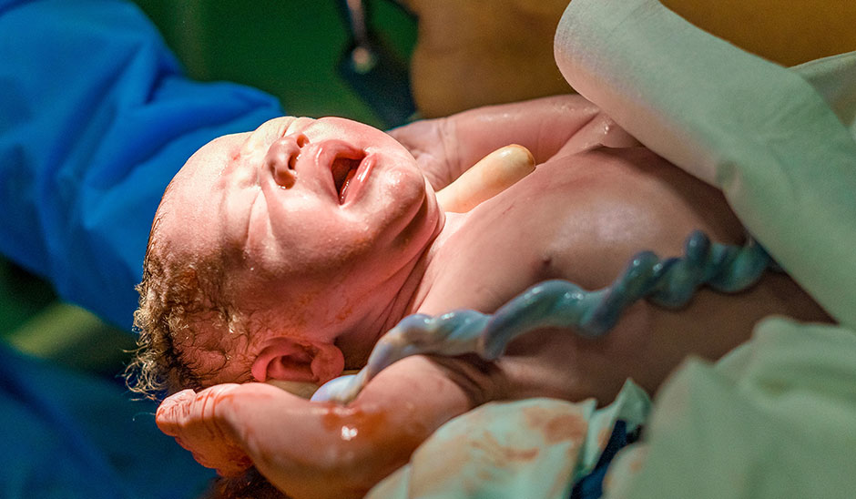 newborn umbilical cord