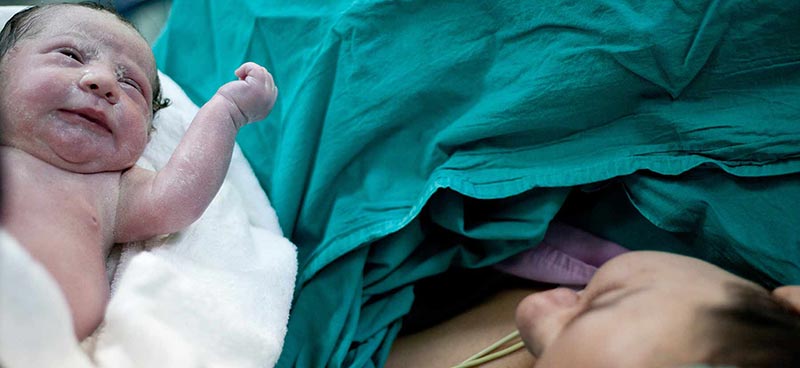 delayed c-section errors