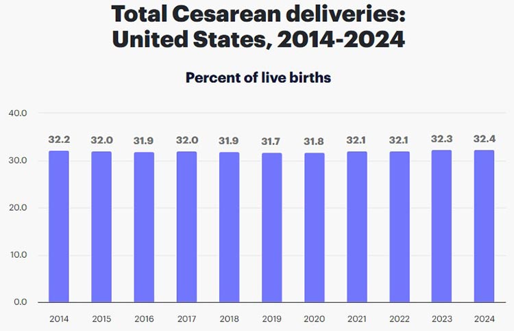 united states live births