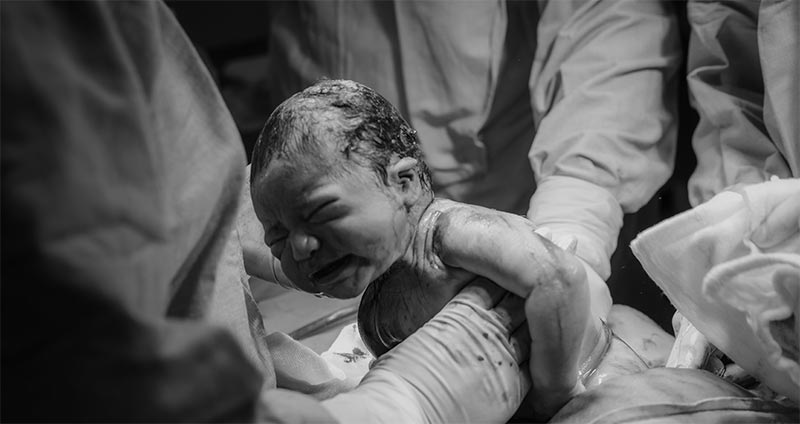 newborn delivery