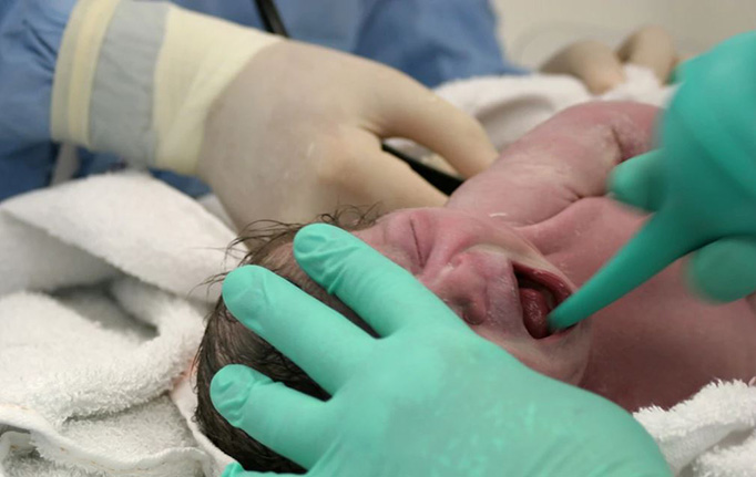 newborn suction and clearing