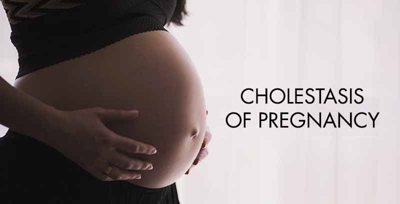cholestasis of pregnancy