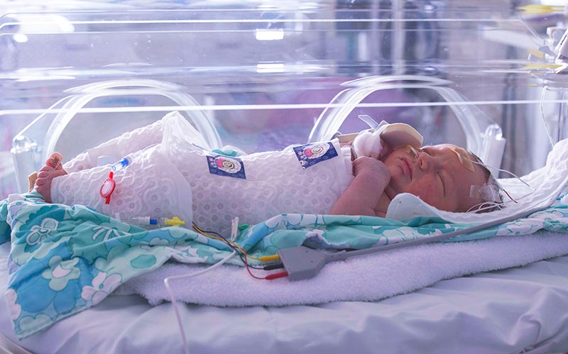 Neonatal Brain Cooling