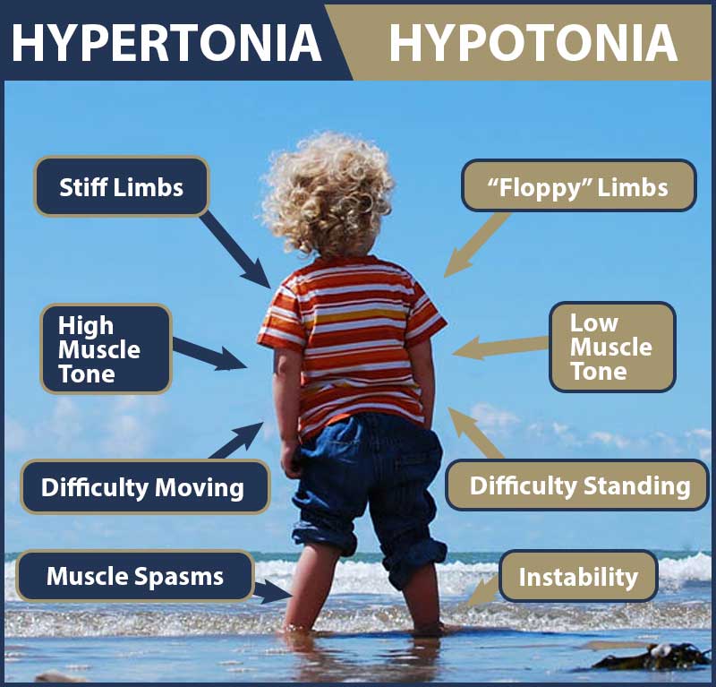 cerebral palsy symptoms