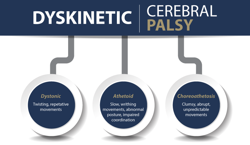 Dyskinetic Cerebral Palsy