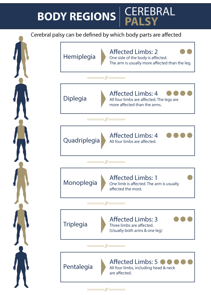 Body Regions Affected by CP