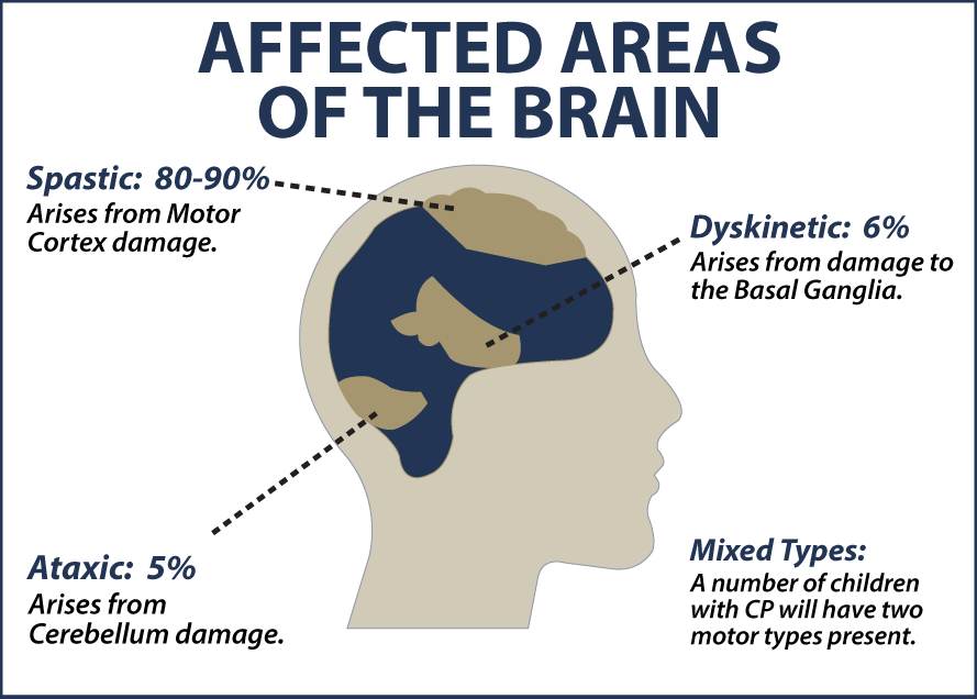 disorder caused by brain damage