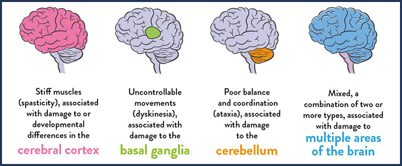 Cerebral Palsy Brain Sections