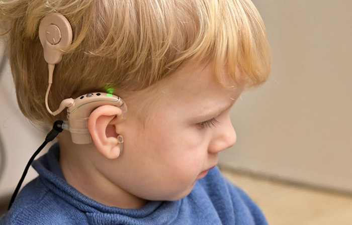 Cochlear Implant