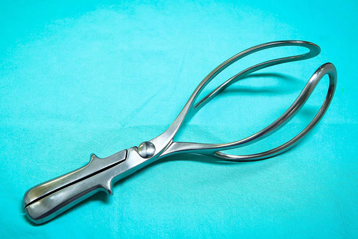 forceps delivery