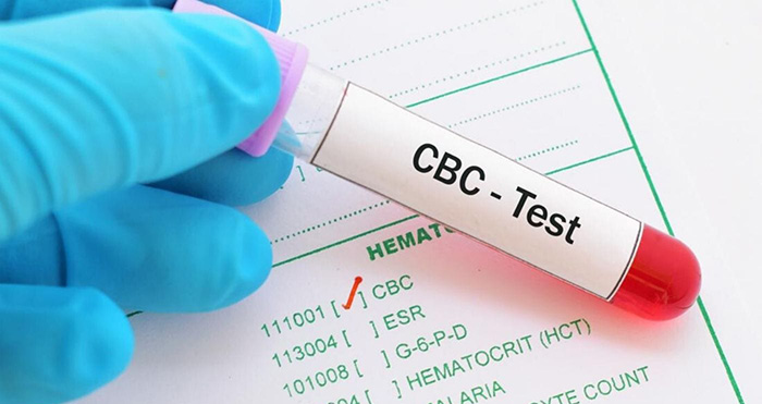 Complete Blood Count Test for HELLP Syndrome