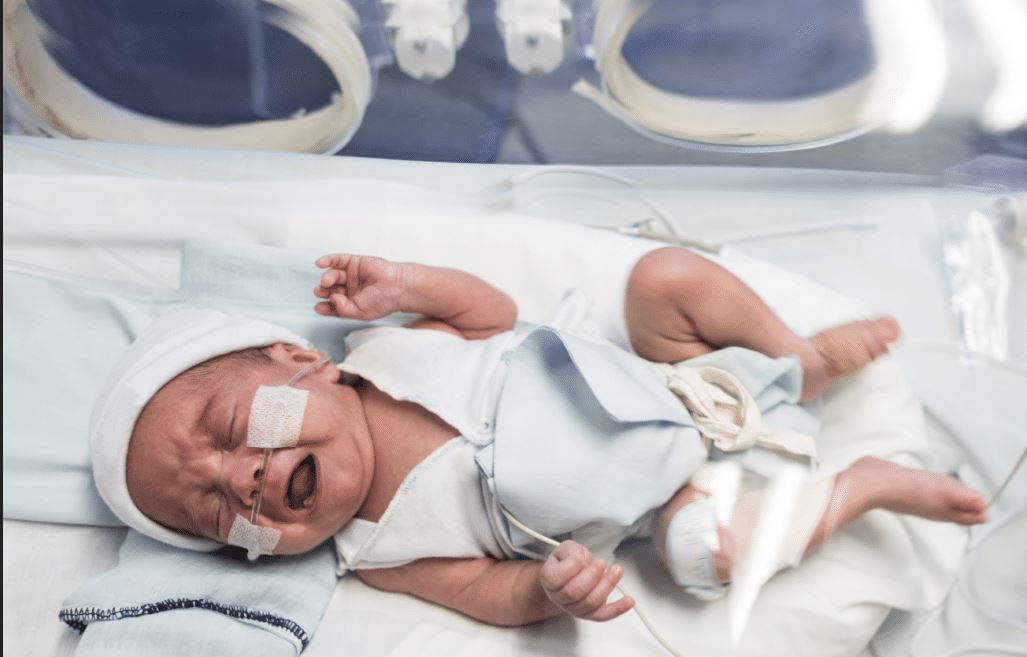 NICU Baby being treated