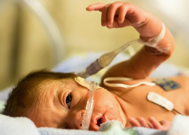 HIE Birth Injury NICU