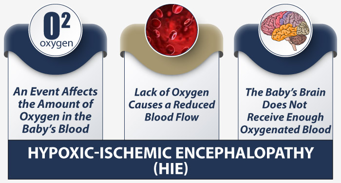 Hypoxic Ischemic Encephalopathy Process