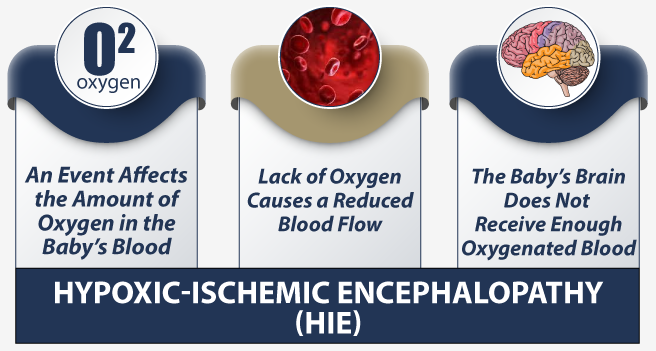 What is Hypoxic-ischemic encephalopathy?