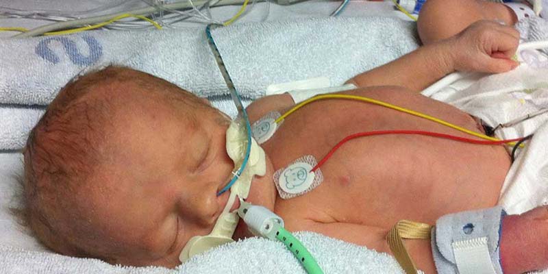 Treating HIE Brain injury
