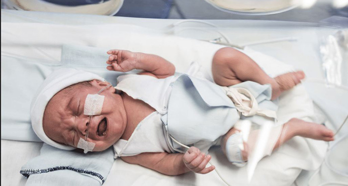 Baby in the NICU