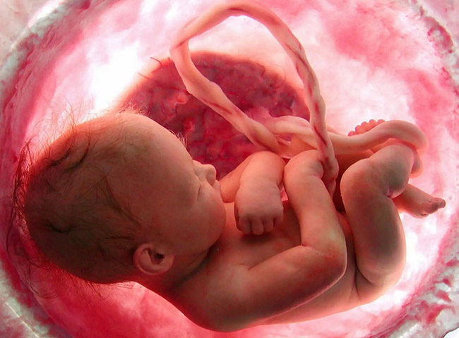 fetus with umbilical cord