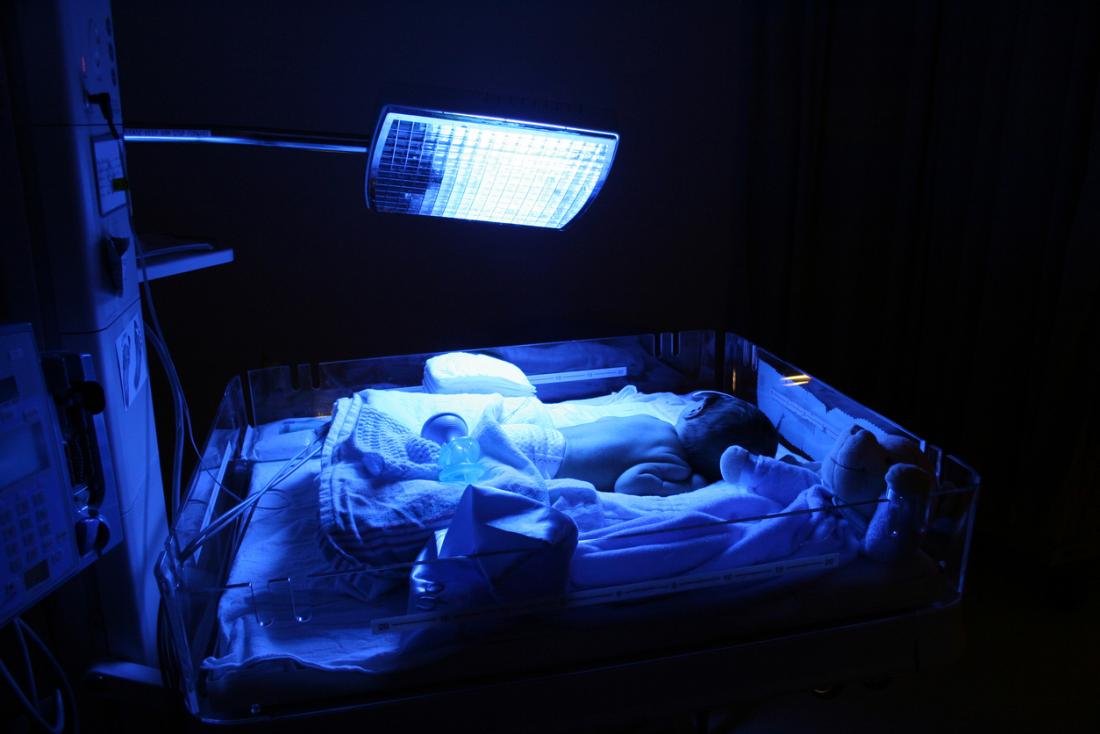 UV phototherapy birth injury prevention