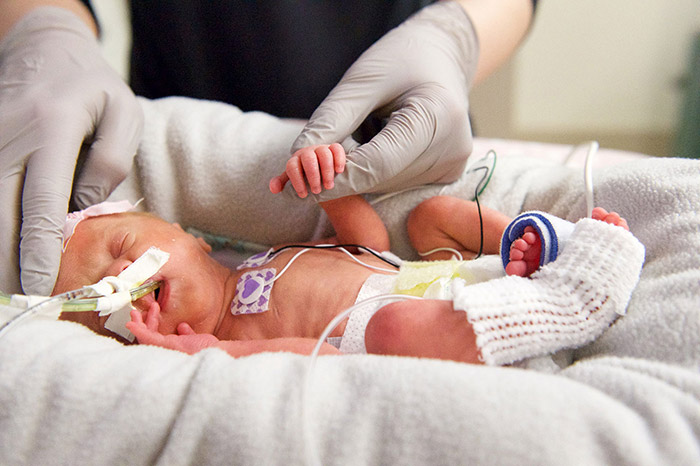 baby in NICU