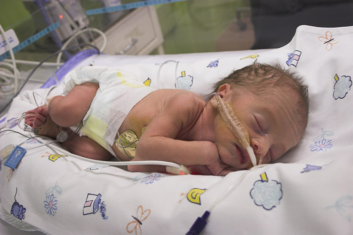 NICU Preemie