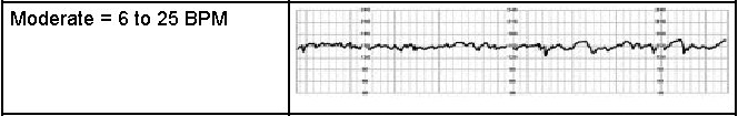 Moderate Variability