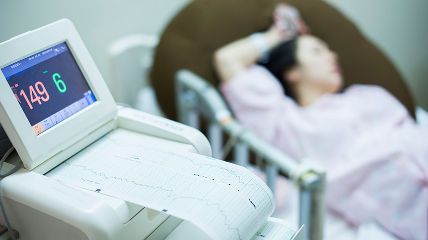 fetal heart rate tracing