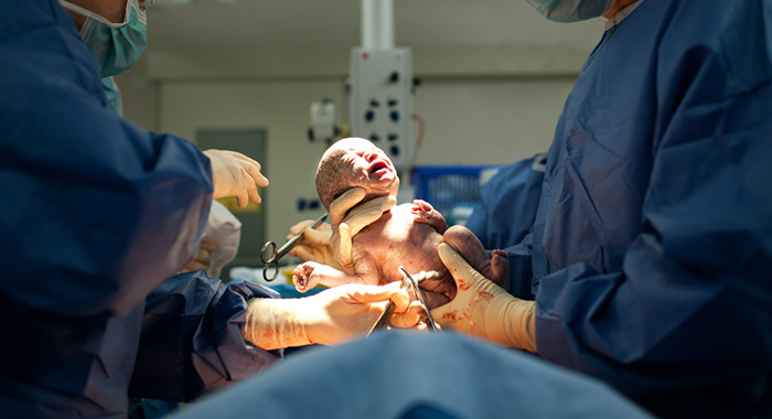 c-section birth