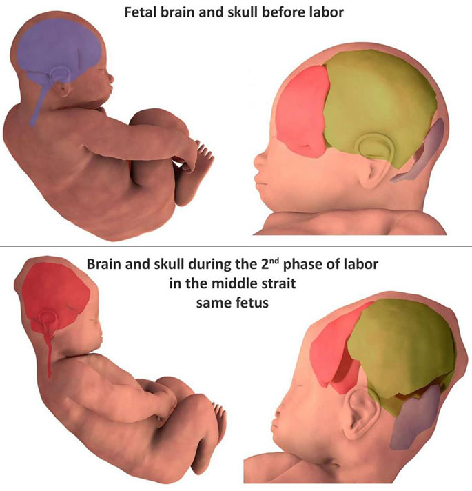 head molding