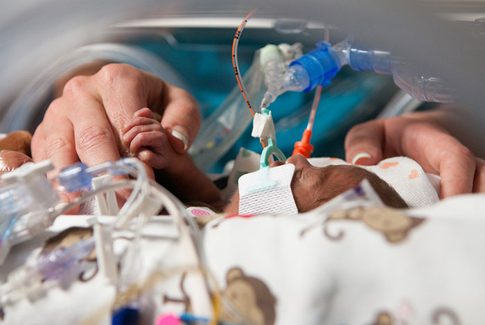 NICU Treatment