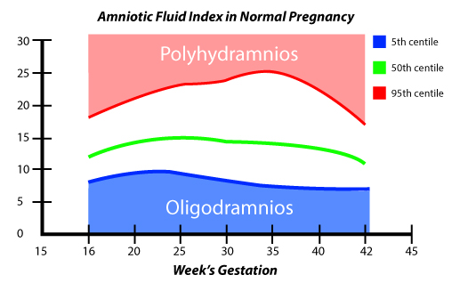 Polyhydramnios Complication Chart