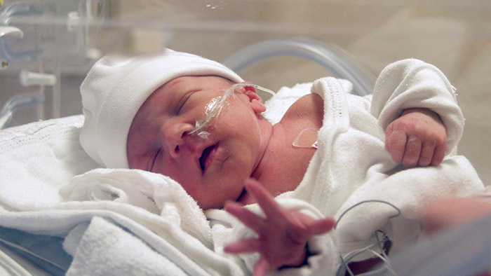 NICU Premature Birth